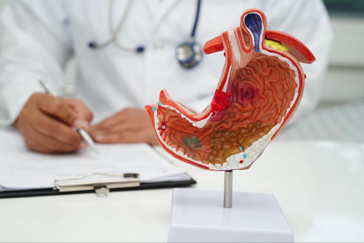 胃の内部を表した模型