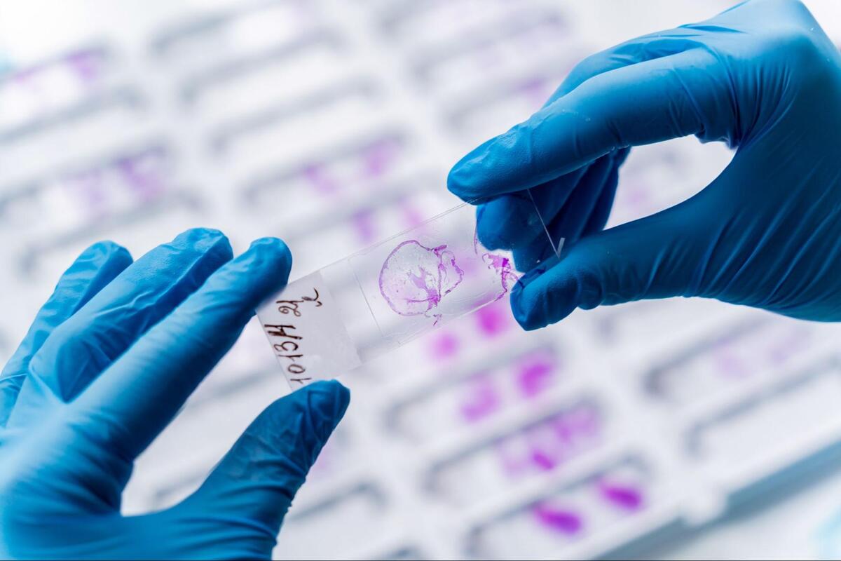 病理検査の様子