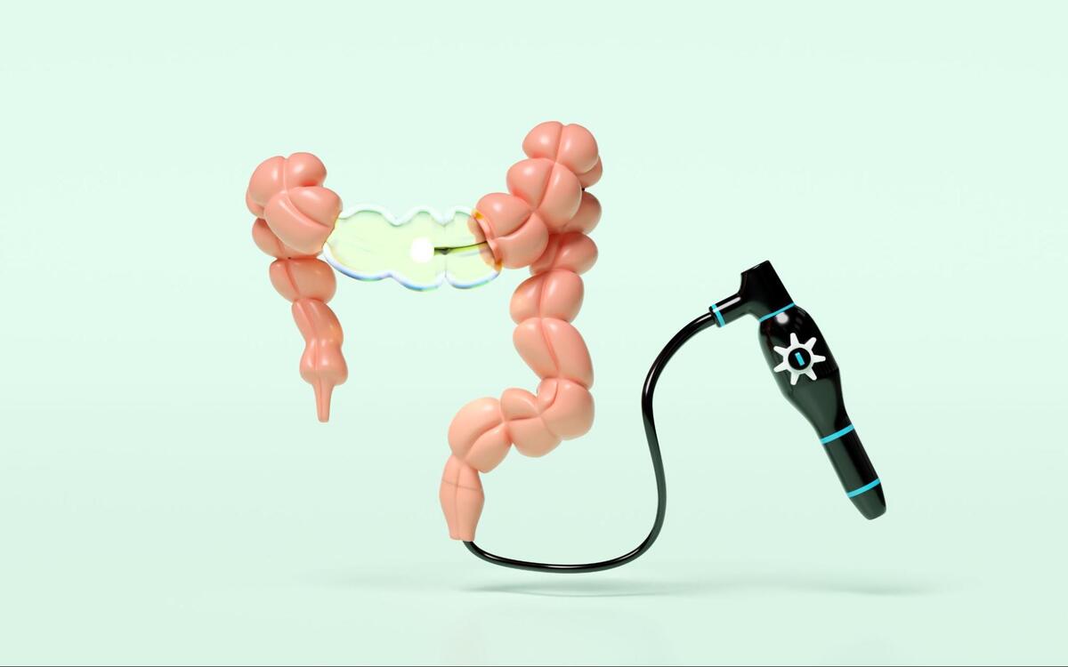 大腸カメラ検査を表した模型