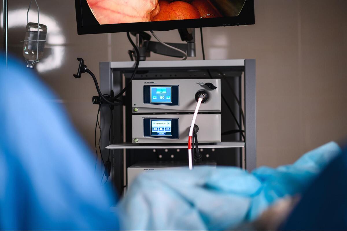 大腸内視鏡検査に使用する機器とモニター